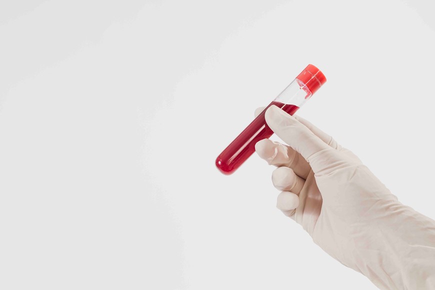 Doenças coronárias podem ser identificadas por exame de sangue