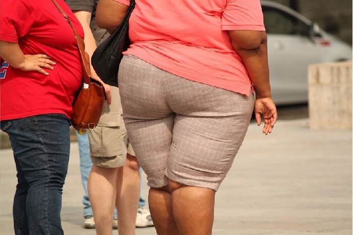 Obesidade é o segundo fator de risco para covid-19, atrás apenas da idade